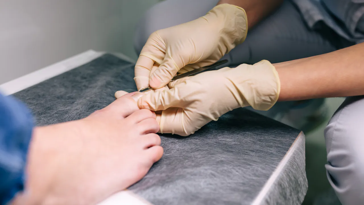 Podiatrist in gloves treating a patient's toes on a clinic couch